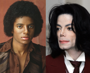 Michael Jackson Plastic Surgery